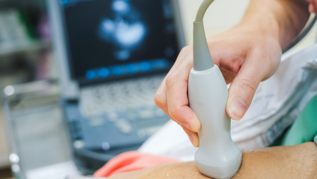 Ecocardiograma